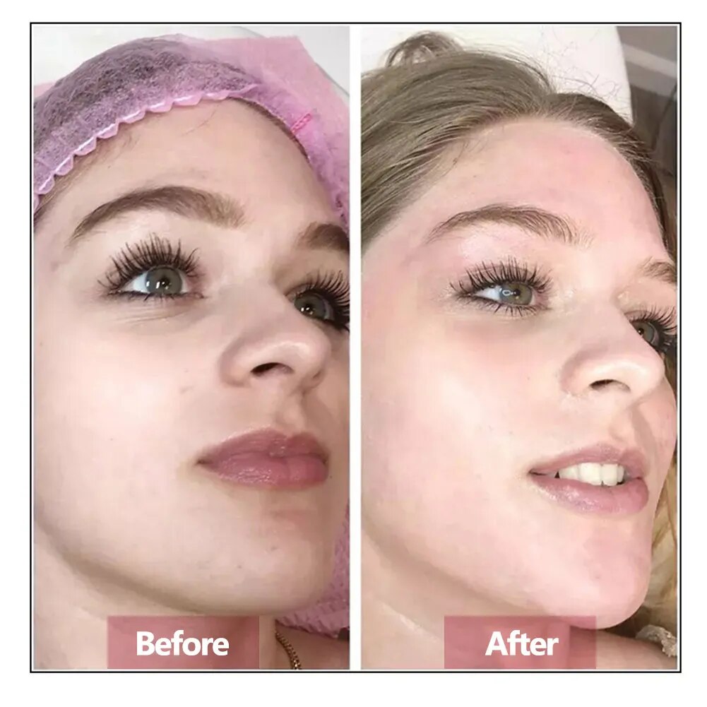 Hyaluron säure Gesicht Serum E – Luxury Skincare Wholesale Bewertung und Preis